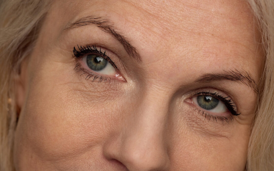 Zmarszczki mimiczne – kiedy warto je wygładzić zabiegiem
